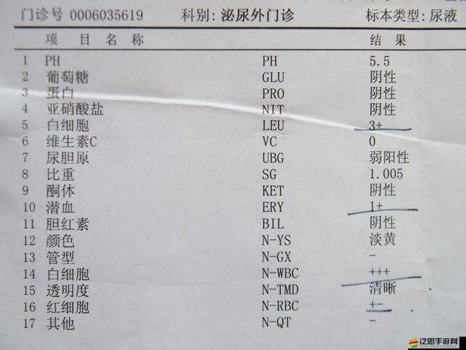 胡桃尿流出白色膿狀的異常情況