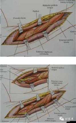 睡醒發現還在 C1v1 骨科：這奇妙的境遇究竟意味著什么呢