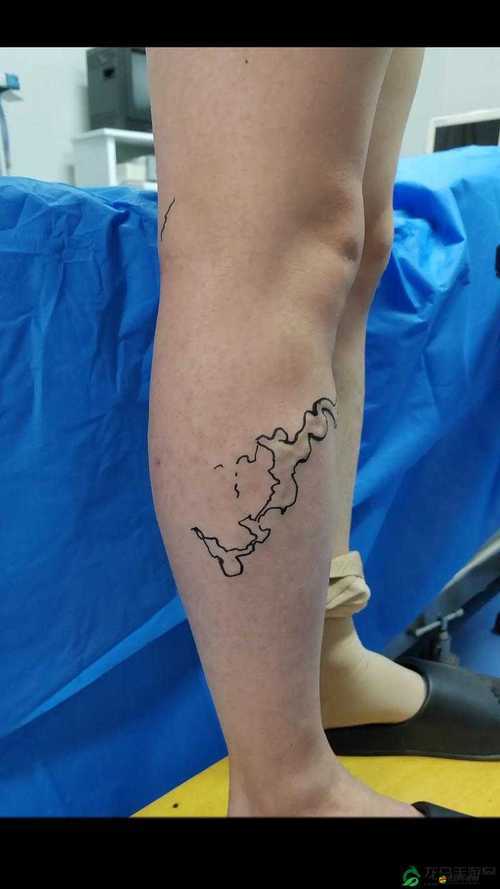 竹板打腫臂縫合不上：探究這一奇特現象背后的原因及影響