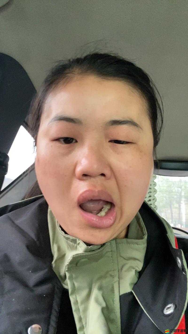 塞滿嘴巴把臉撐大了能恢復嗎：關于臉部變化的相關探討