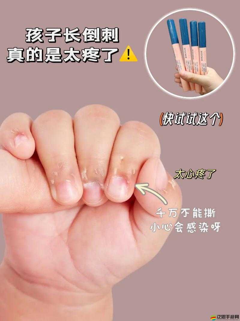 寶寶才兩根手指就疼哭了究竟怎么回事