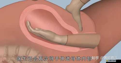內(nèi)檢時醫(yī)生手剝了一圈，這是怎么回事