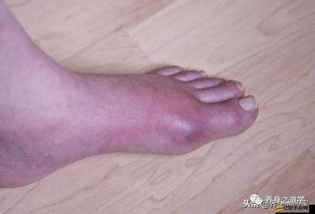 女人晚上蓮花開害處大需警惕莫忽視
